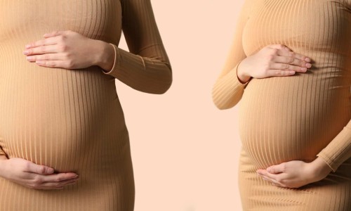 孕期为什么身上老是油腻腻的-权威怀孕后身上长了很多褐色斑点平台,分享专业怀孕后身上起了好多痘痘知识_怀孕后身上爱出油网